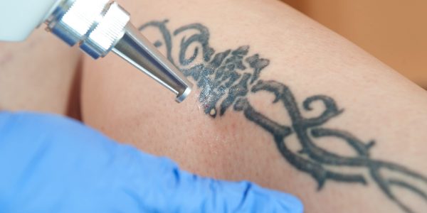 A Close Up Of A Tattoo